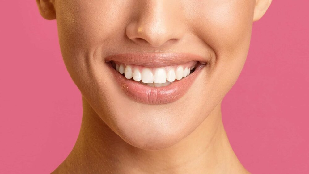 Teeth Whitening Boise