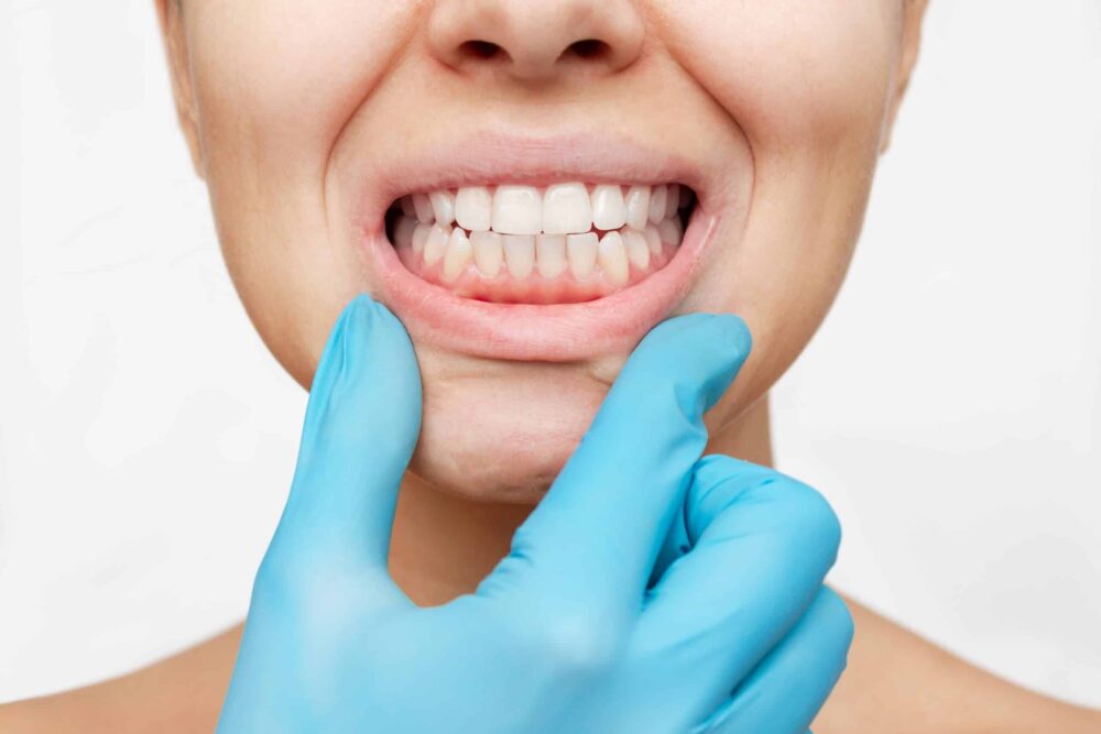 Gum Disease Treatment Boise